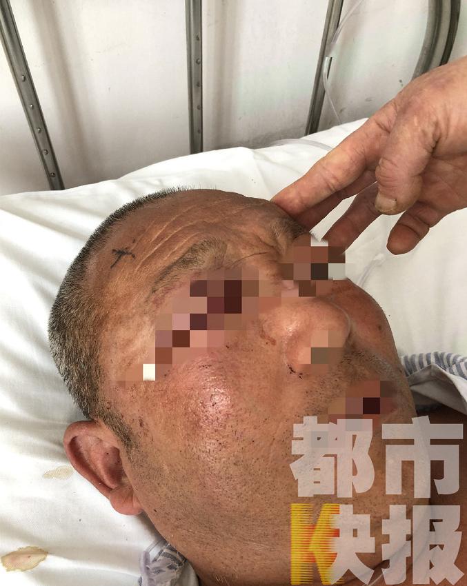 男子除夕夜烟花悲剧，右眼失明引发深度关注，安全警钟长鸣！游戏人生中的残酷现实篇章。